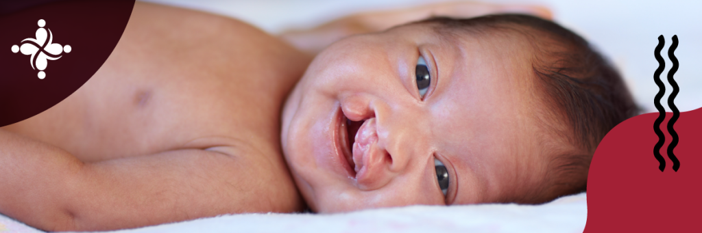 5 Most Common Types of A Birth Defect in The United States